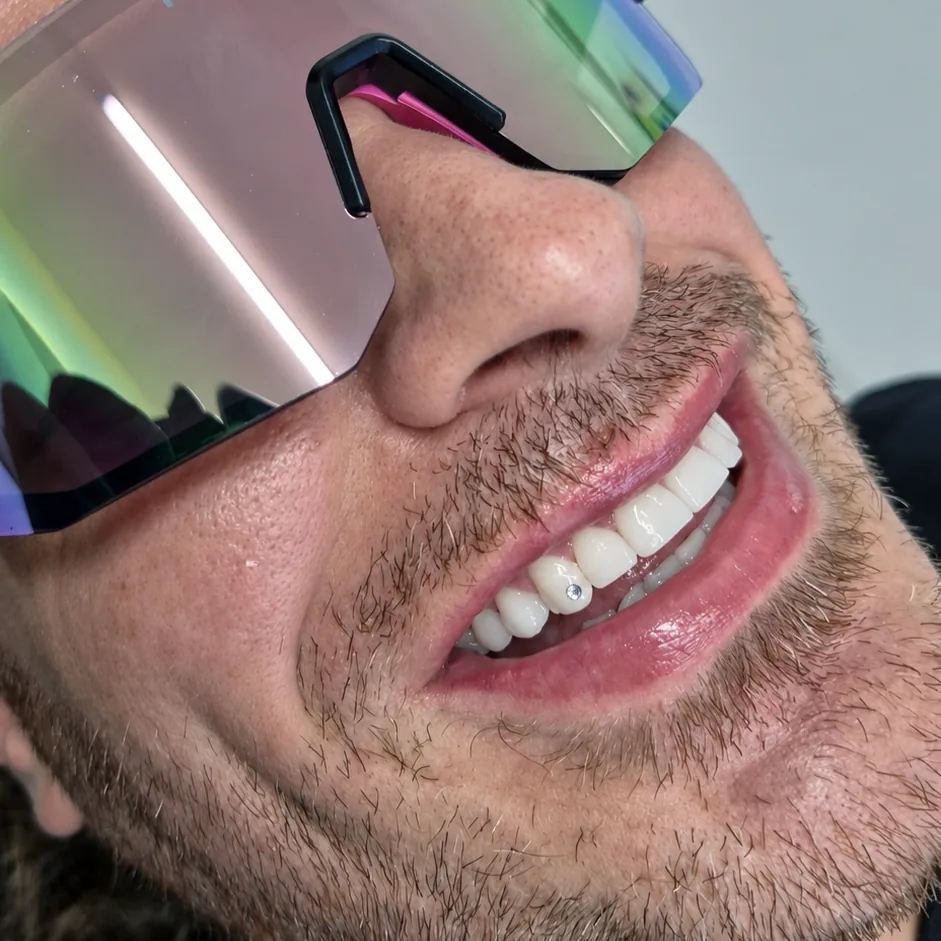 Paciente mostrando su sonrisa después del tratamiento